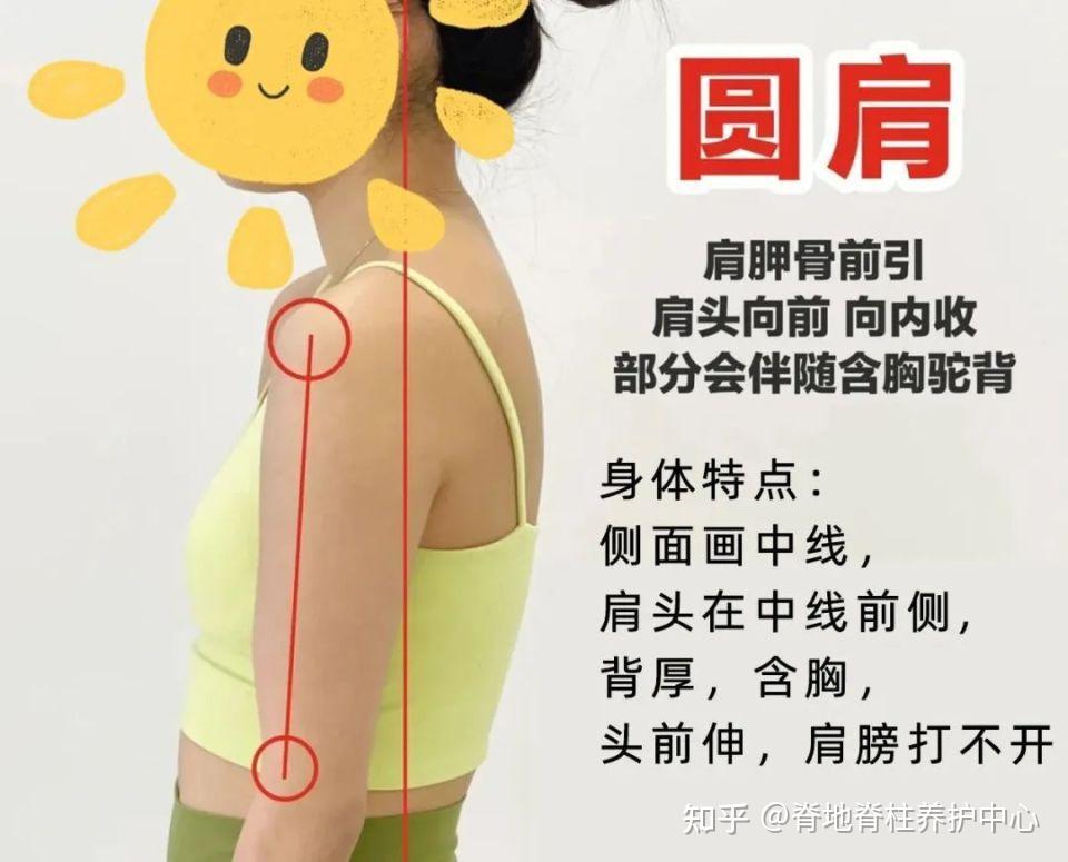 脊地小课堂|90%的人分不清圆肩,翼状肩与驼背,赶紧自我评估一下吧