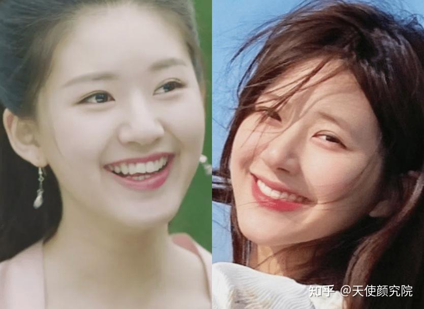 除了她之外,还发现之前明明牙齿多少都有点问题的00后小花赵露思,周也