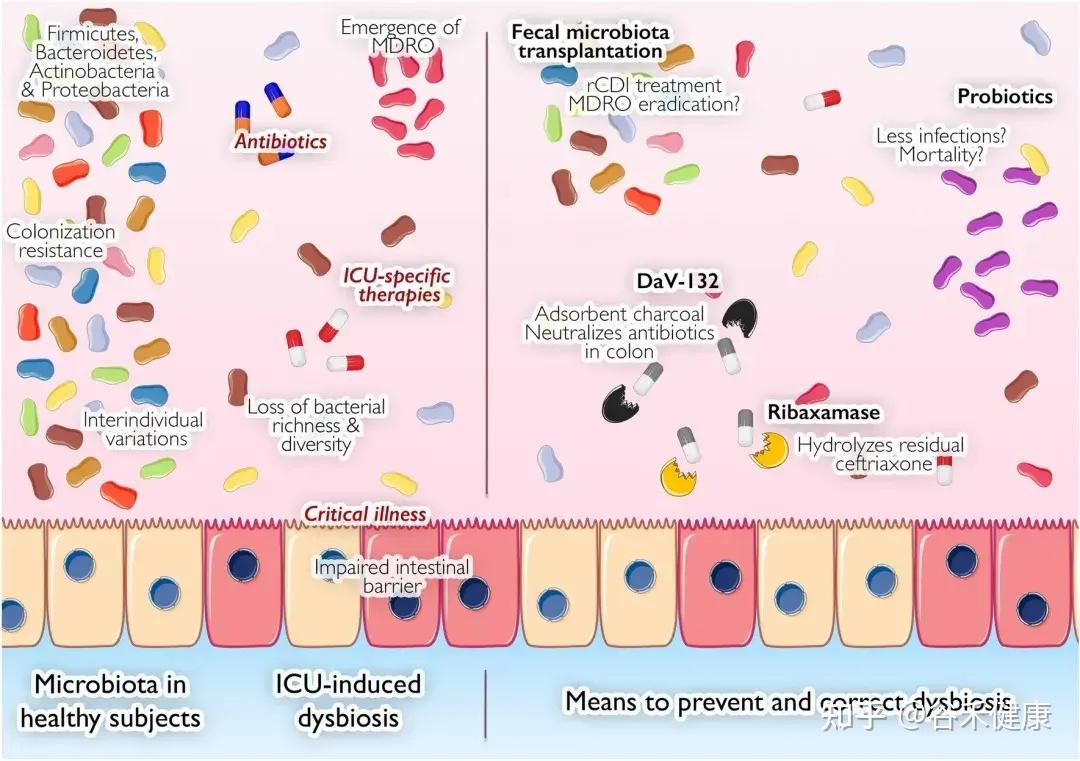 危重症病人的肠道危机和管理干预- 知乎