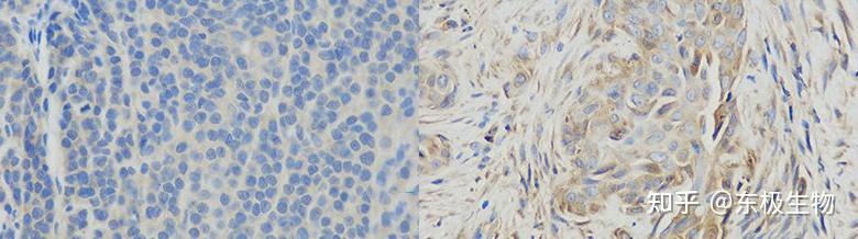 一文教你免疫组化结果怎么看 - 知乎