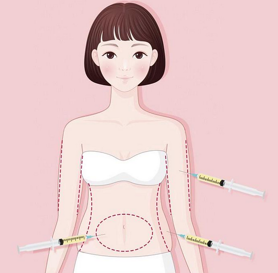 吸脂术后,如何修复凹凸不平的皮肤? - 知乎