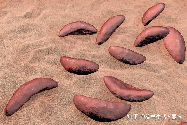 什么是弓形虫有什么危害弓形虫病需做什么检查