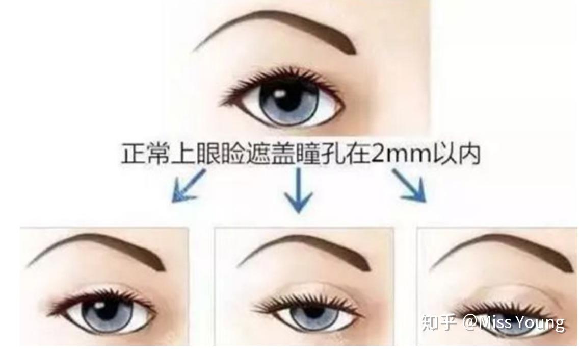 为什么很多人都有左右脸，以及大小眼，甚至有的鼻子大小都不一样的情况？ - 知乎