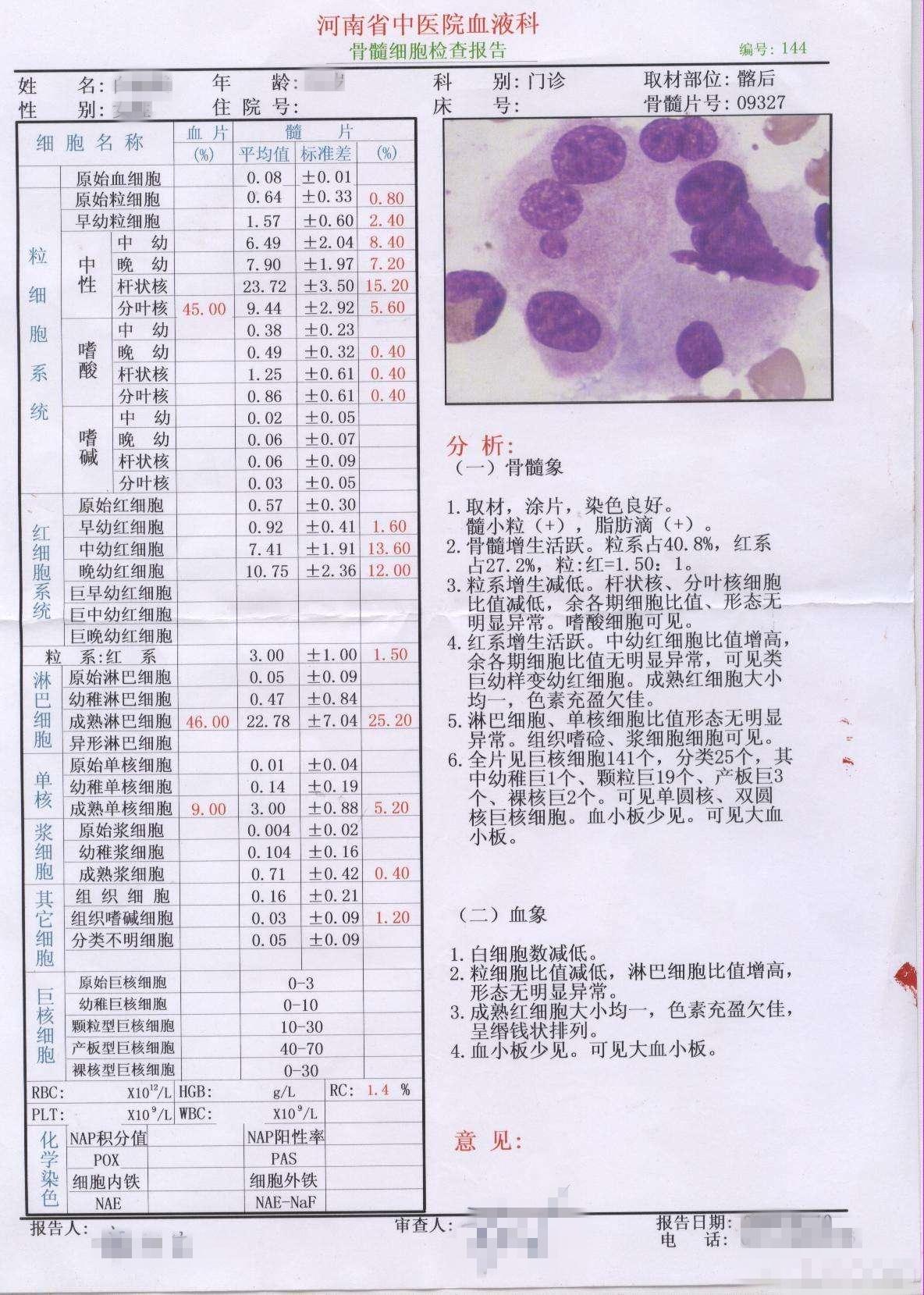 白血病病理与保险条款解读 知乎 白血病病理与保险条款解读 知乎