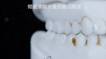 冲牙器 水牙线 洗牙器 洁牙机和电动牙刷是智商税吗 有必要买吗 怎么用 哪个牌子好 博皓 舒客 贝医生 罗曼 飞利浦 洁碧 松下 美的 素士等平价品牌推荐