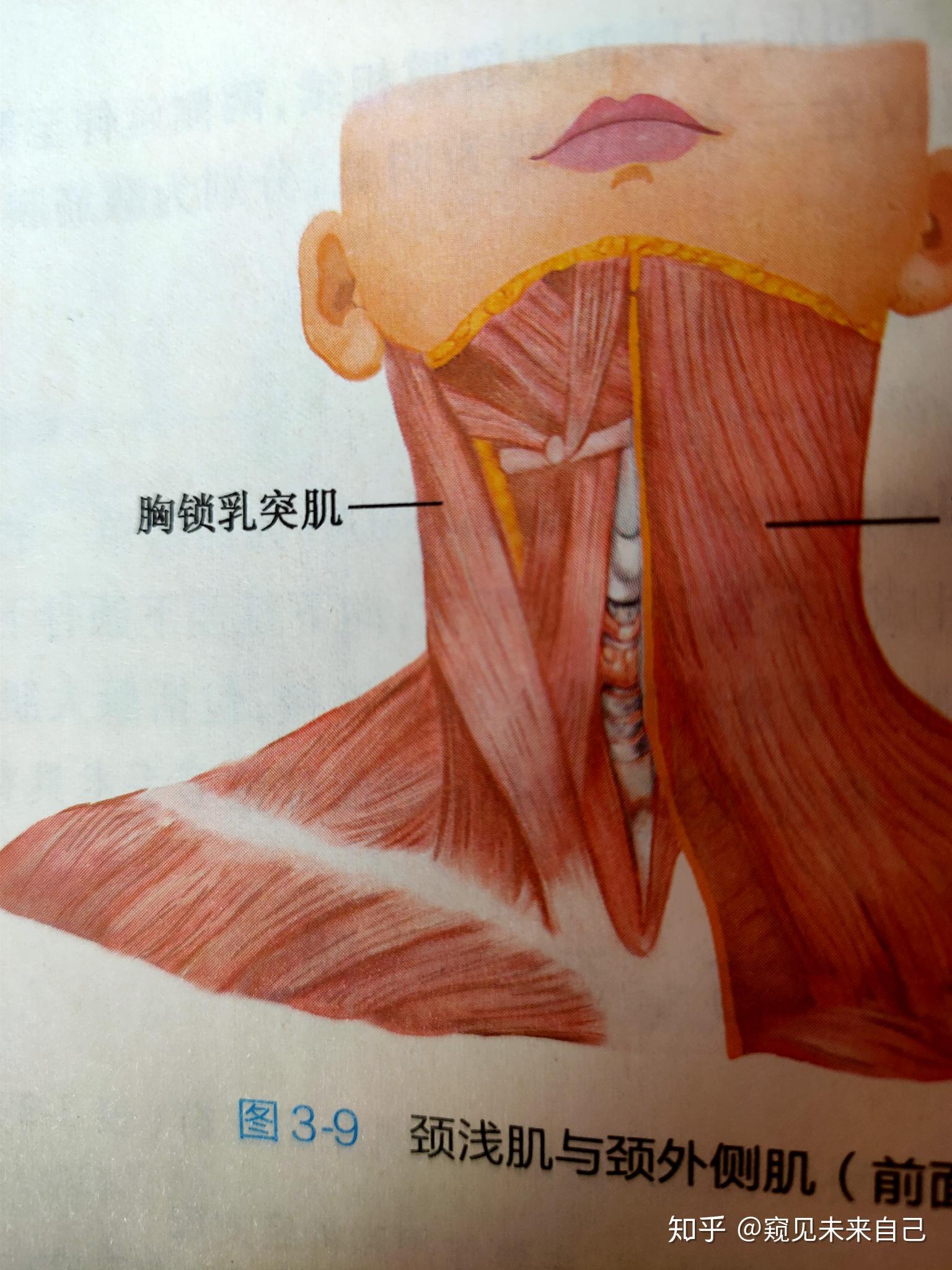 胸锁乳突肌前后缘图片
