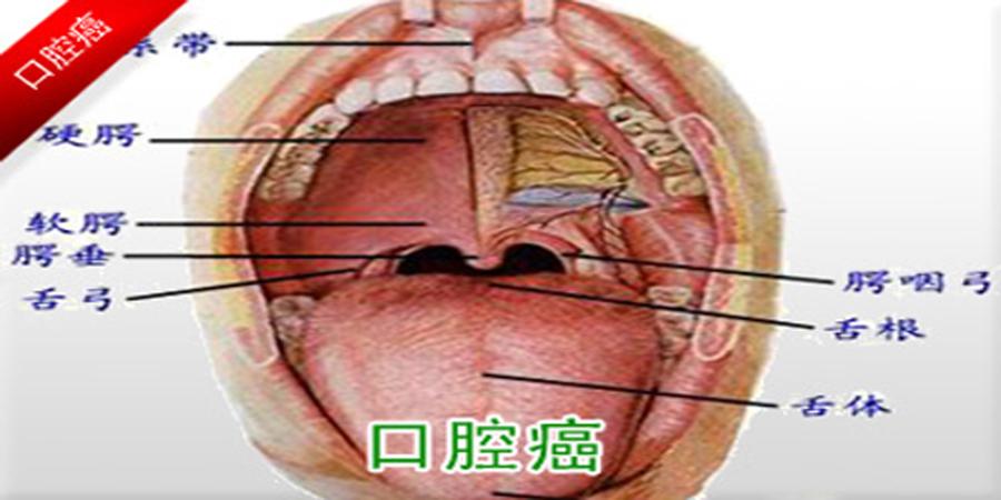 口腔癌的早期症状及原因汇总 知乎