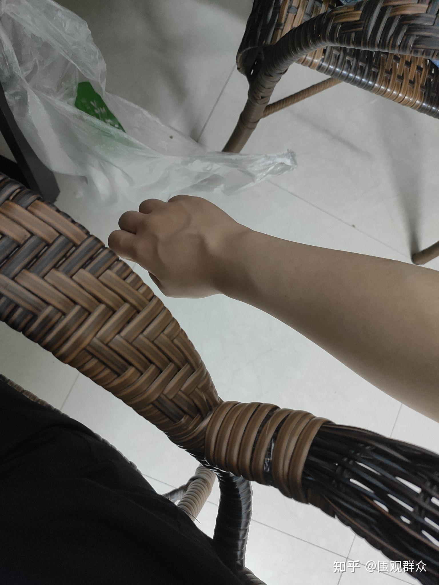 我一姑娘手青筋这般凸爆以后会越来越严重吗