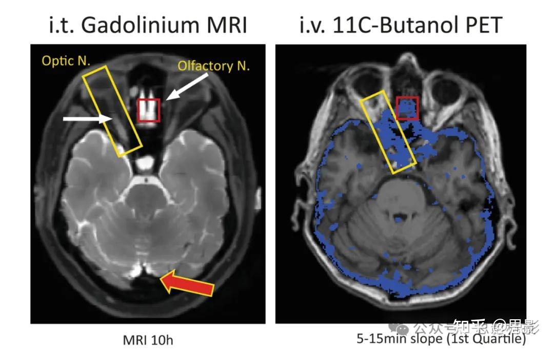 当前对神经液体解剖学、生理学与磁共振成像的理解 - 知乎