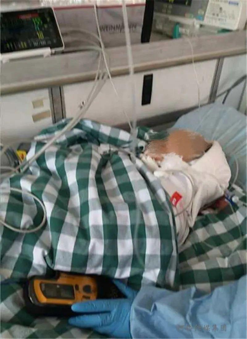 天降砖块,14月龄宝宝被砸脑死亡