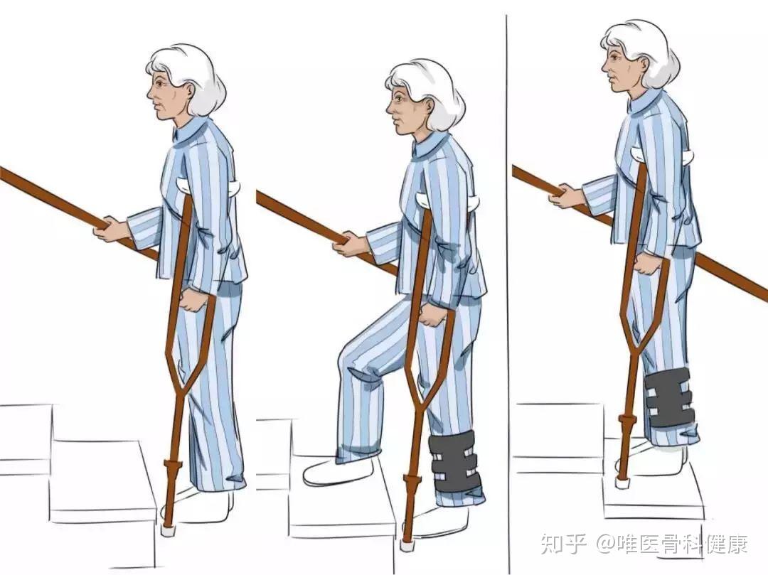 可调式髋膝踝足固定器