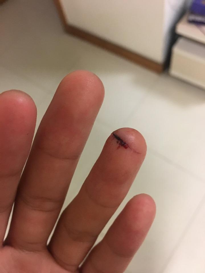 切菜时切到手是一种什么样的体验