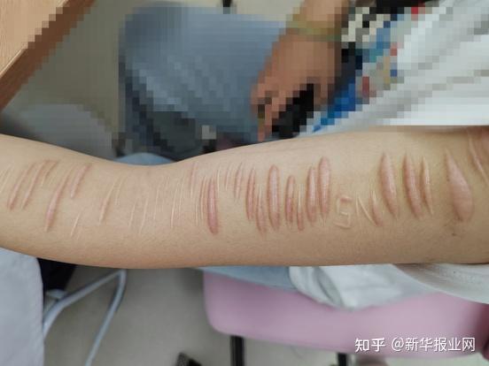 手臂上横亘的每一道疤 都是曾经与生活割裂的证明 - 知乎