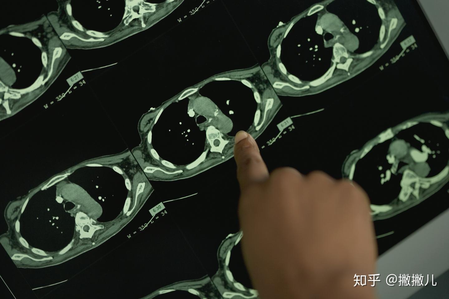 CT常用专业术语解读,建议收藏! - 知乎