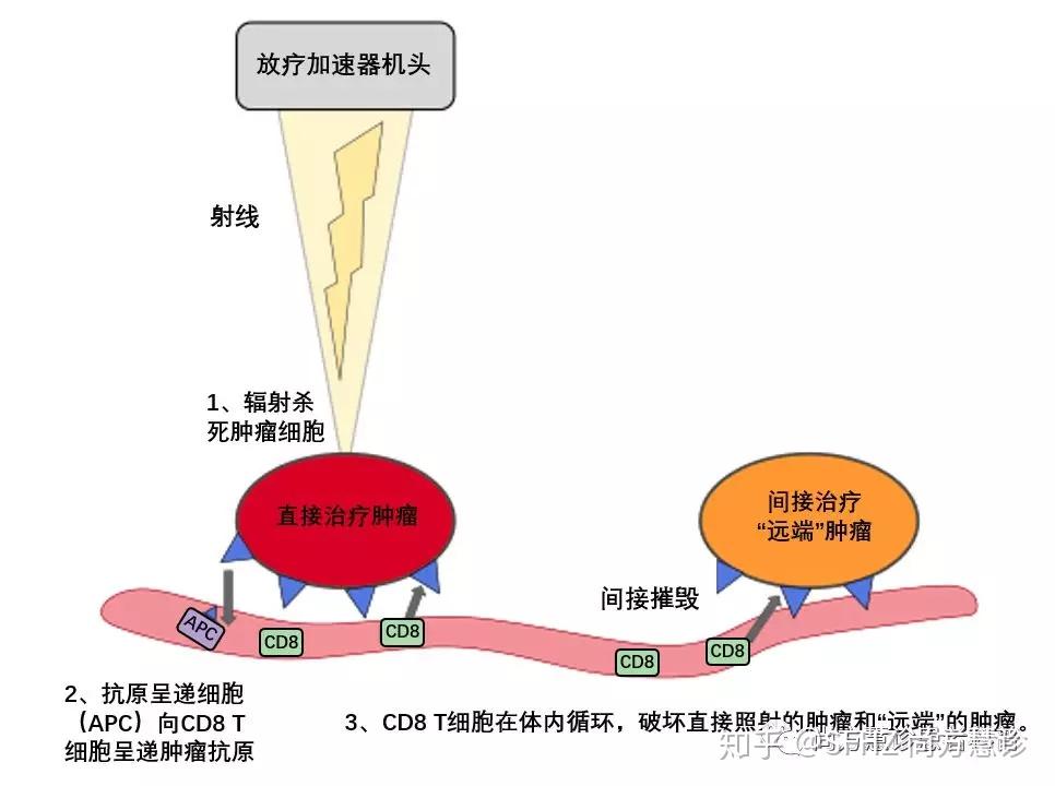 晚期/转移性癌症患者:放疗联合免疫治疗的远隔效应可使生存翻番 - 知乎