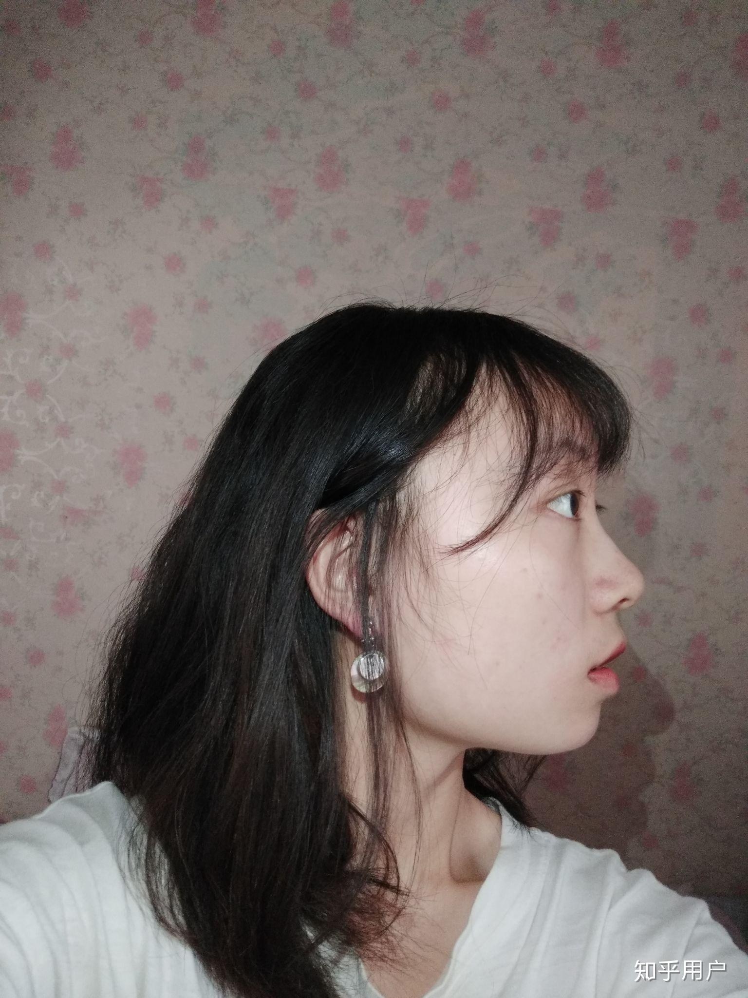 因为方脸 脸宽 下颌骨肥大而自卑怎么办 该不该削骨?