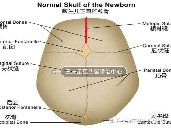 额骨骨缝图片