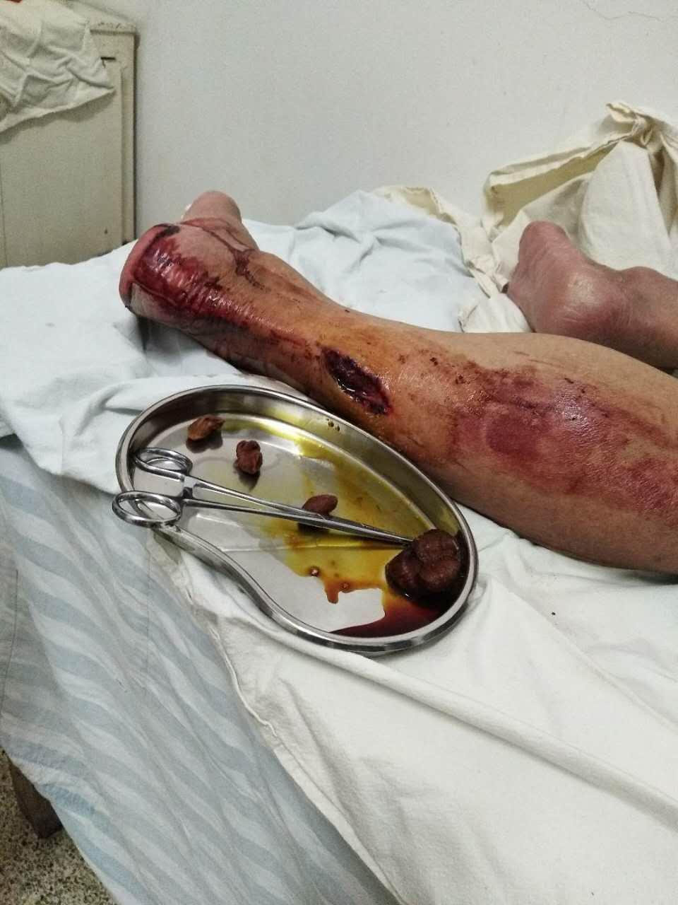 惨江山一伙歹徙擅闯民宅贫困古稀老人倒在血泊中