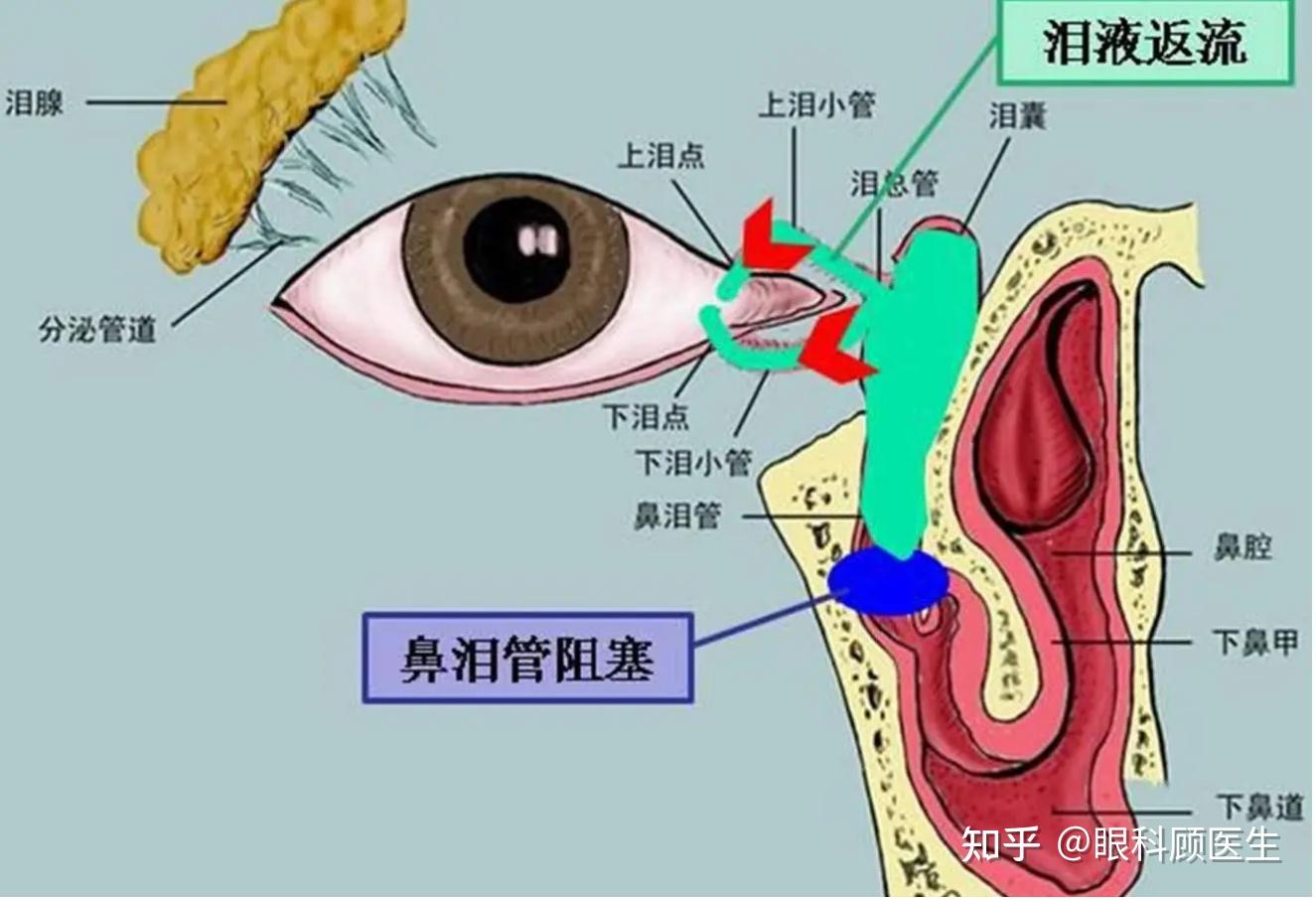 恼人的泪囊炎