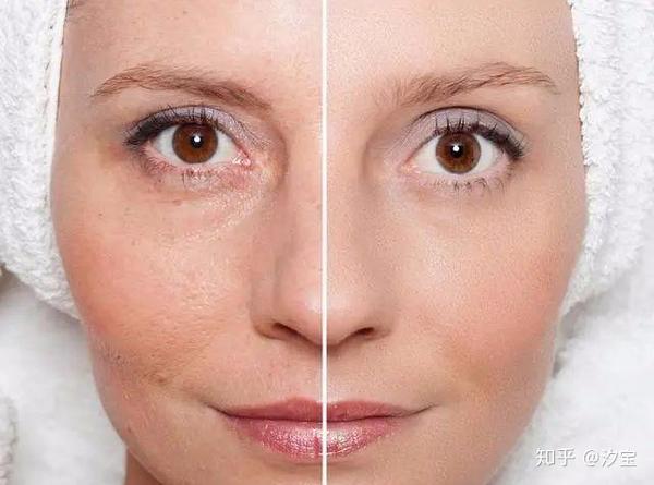 泽佳:油性皮肤和混合性皮肤易混淆?有效学会区分护理!