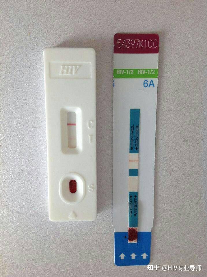 艾滋病试纸包埋线是用来与血液发生反应的位置,是有包被抗原抗体的