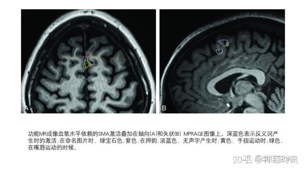 脑功能成像解剖 — 知识分享 - 知乎
