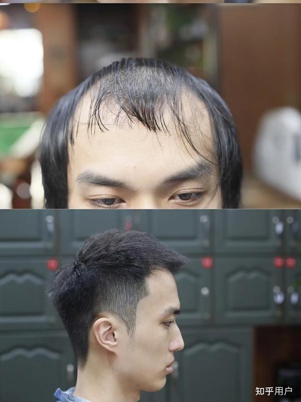 男生头发细软,发量偏少要怎么搭配发型? - 知乎