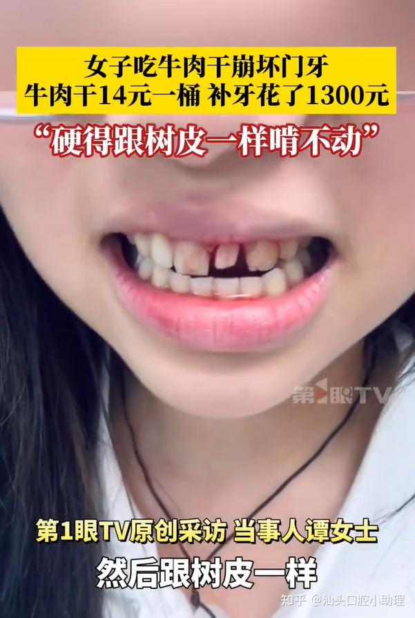 王嘉尔咬裂牙、广东女子吃牛肉干崩门牙…你的牙齿真的没想象中那么