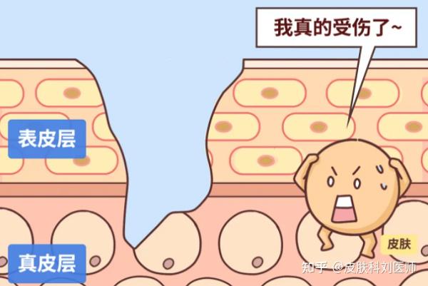 伤口如何处理不留疤? - 知乎