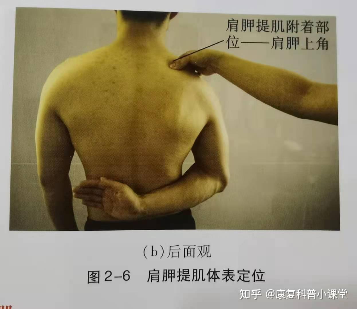 肩胛骨上角和内侧缘上部功能:上方固定,可使肩胛骨上提和下回旋;下方