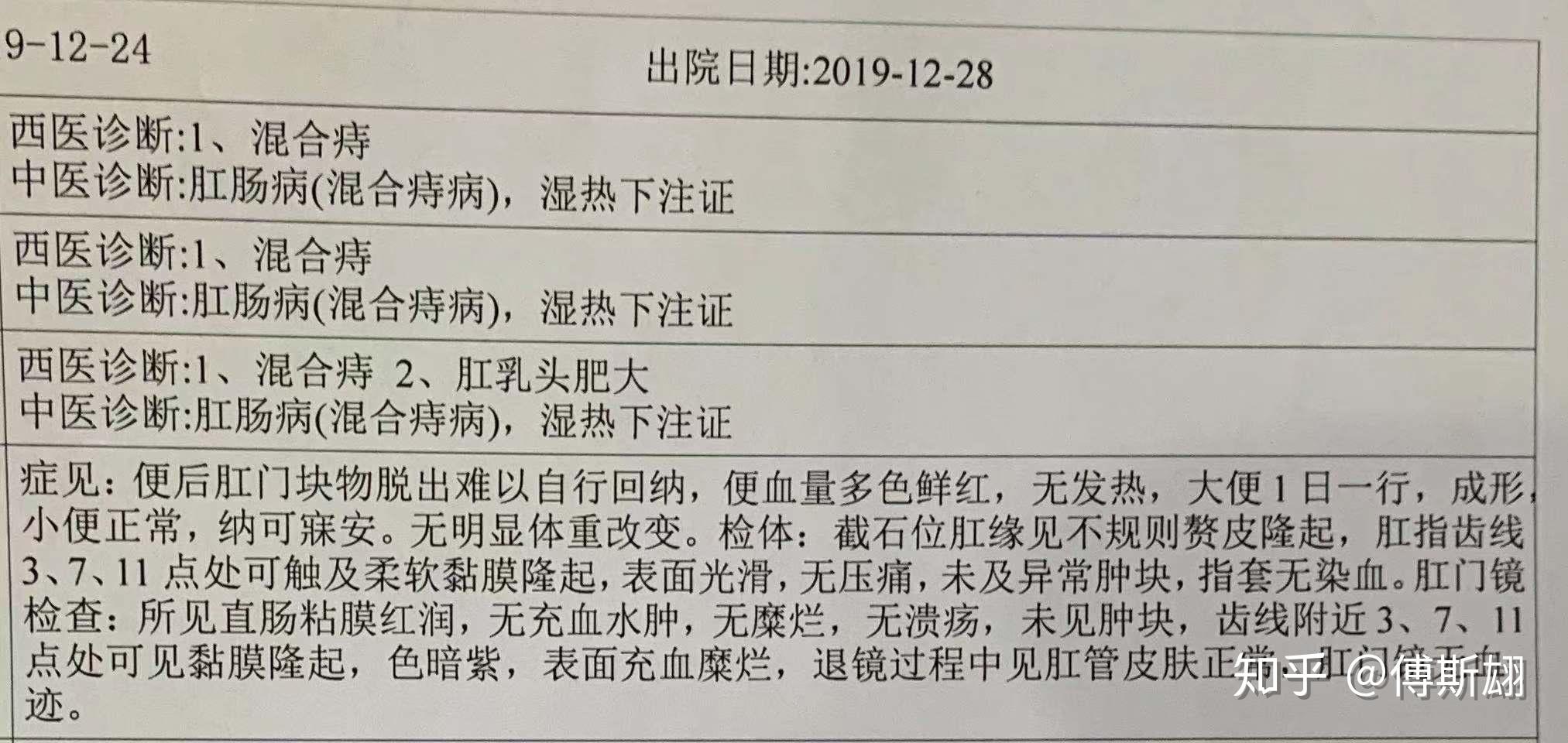 痔疮手术全纪录