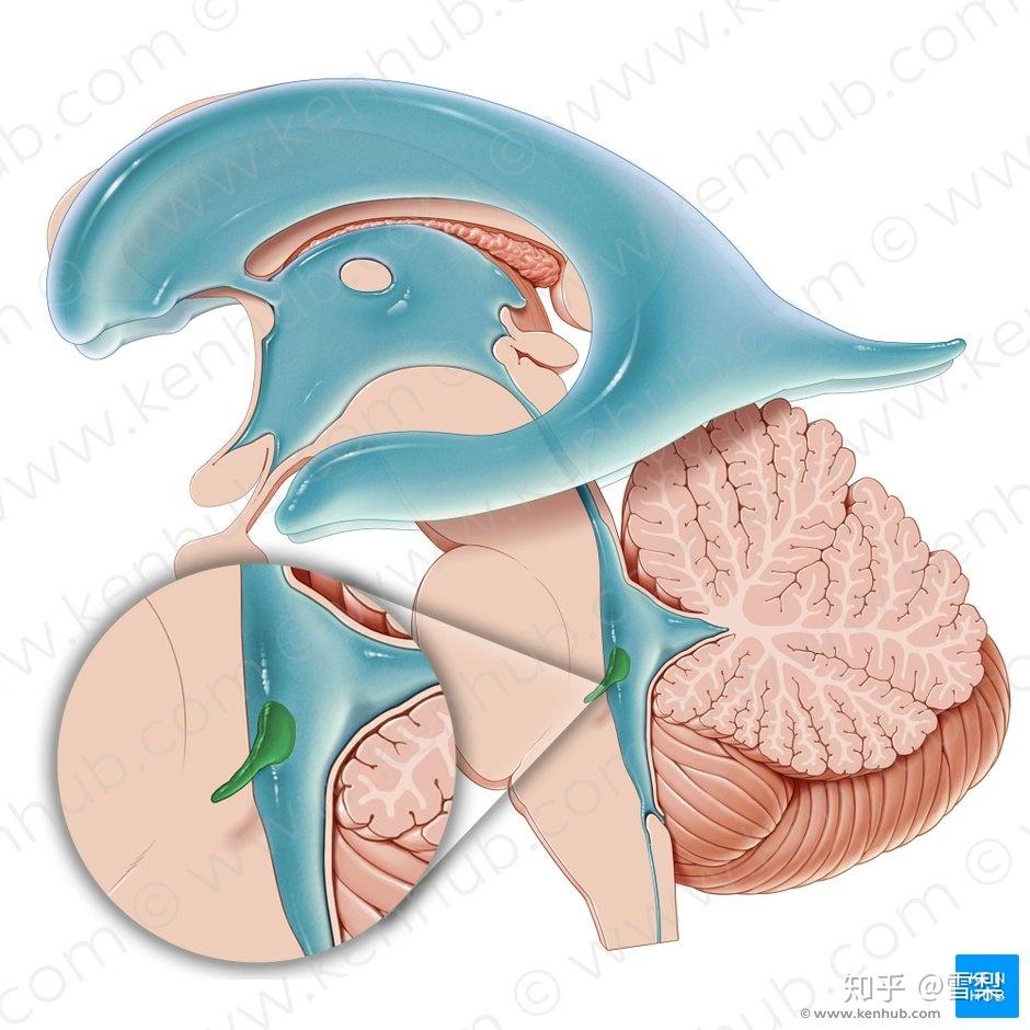 1. lateral walls 侧壁