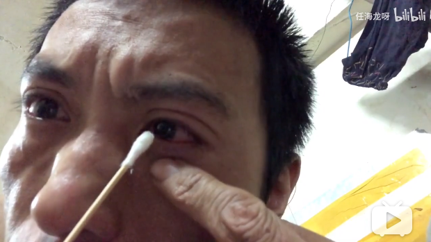 大多数时候,他只能拿棉签沾点眼药水洗一洗,然后闭上眼睛睡一觉.
