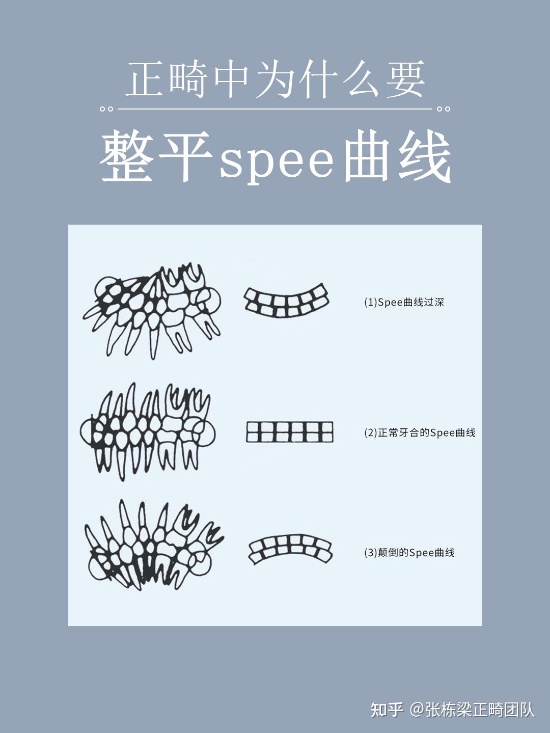 正畸中为什么要整平spee曲线