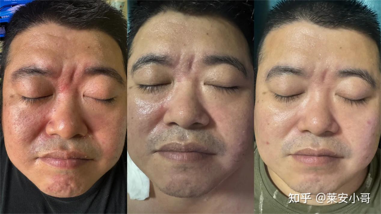 男士护肤品_油皮控油水乳推荐_男士水乳选择指南