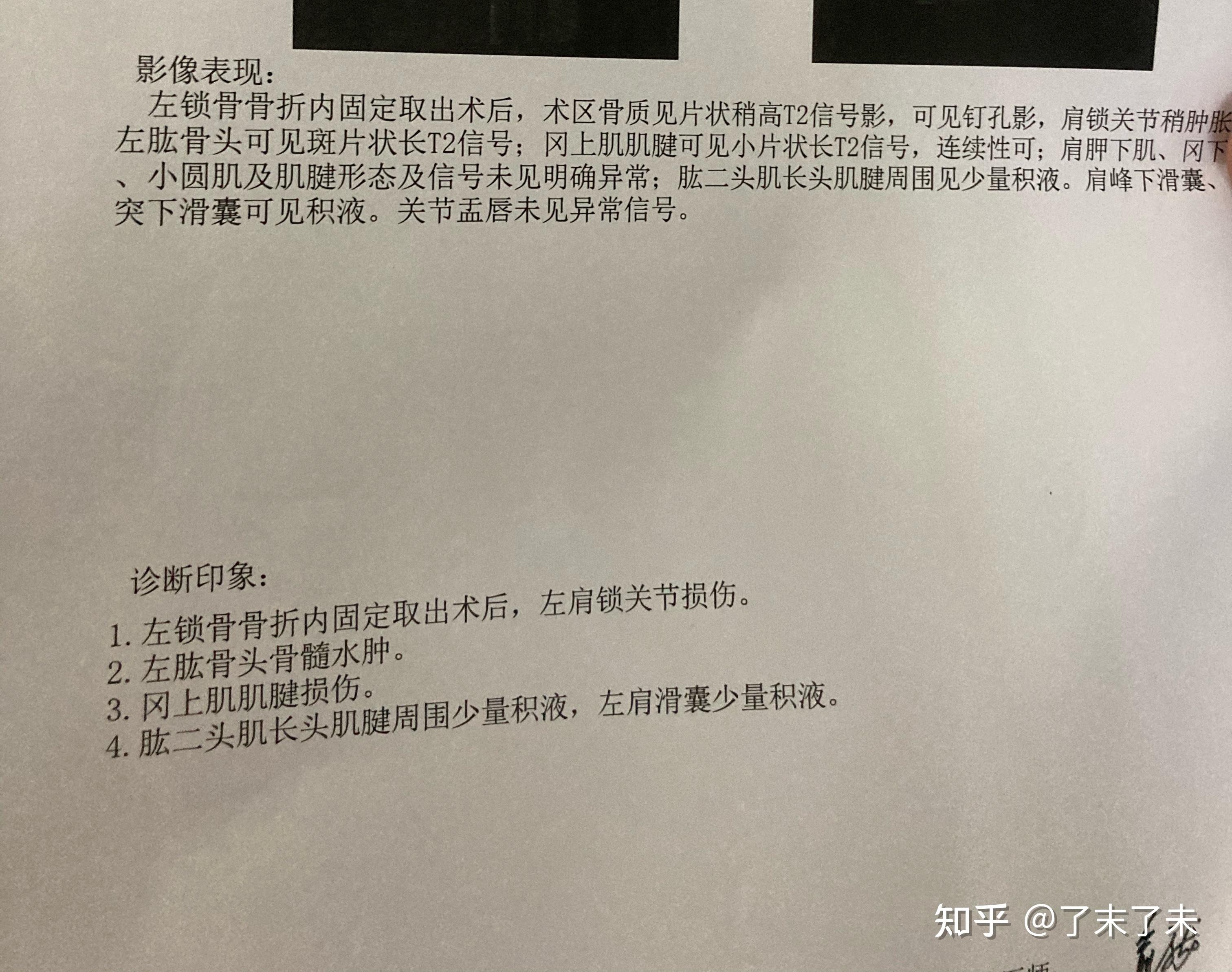 (3),冈上肌肌腱损伤.(2),左肱骨头骨髓水肿.