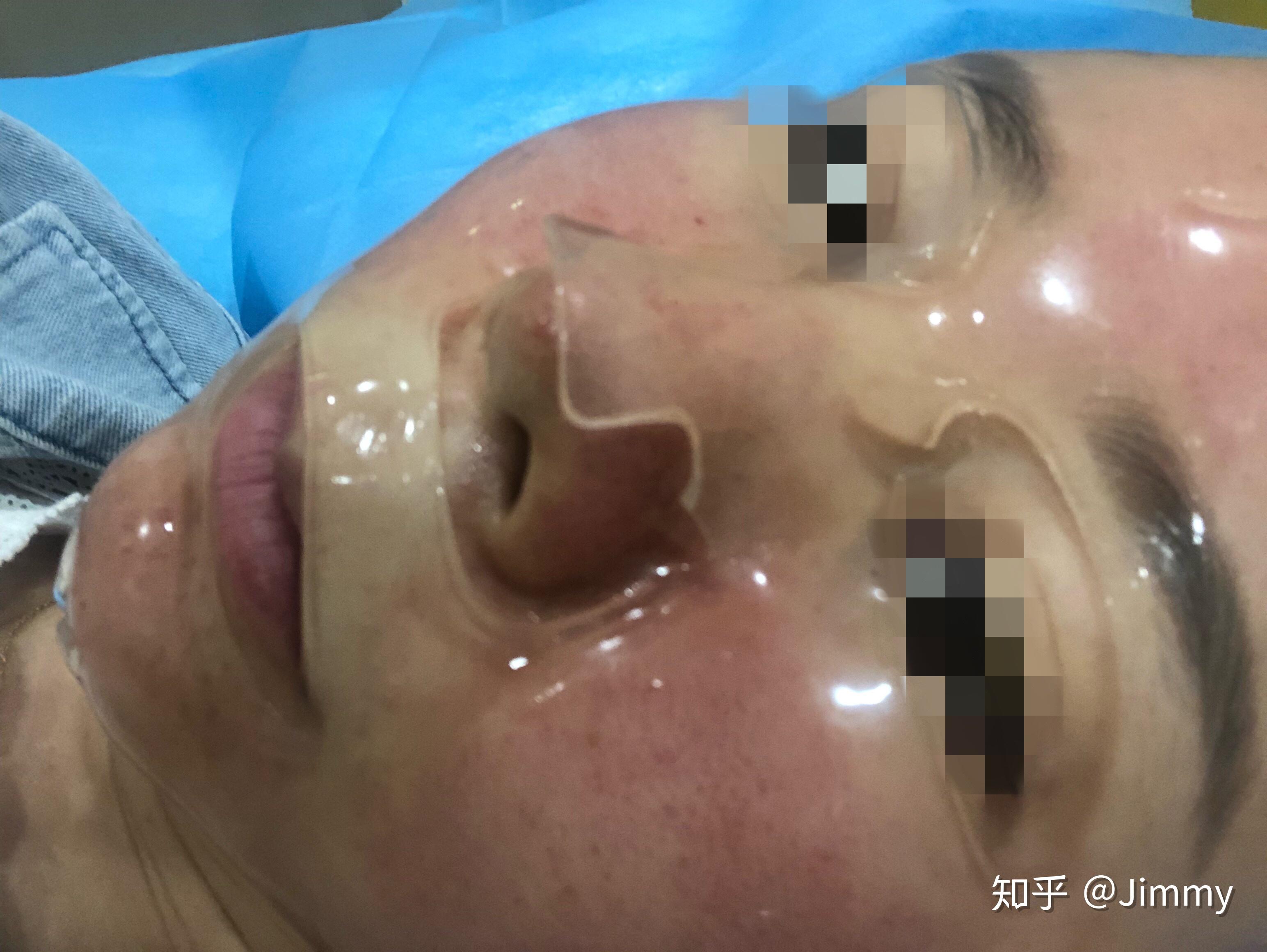 韩国露飞ruffy婴儿针