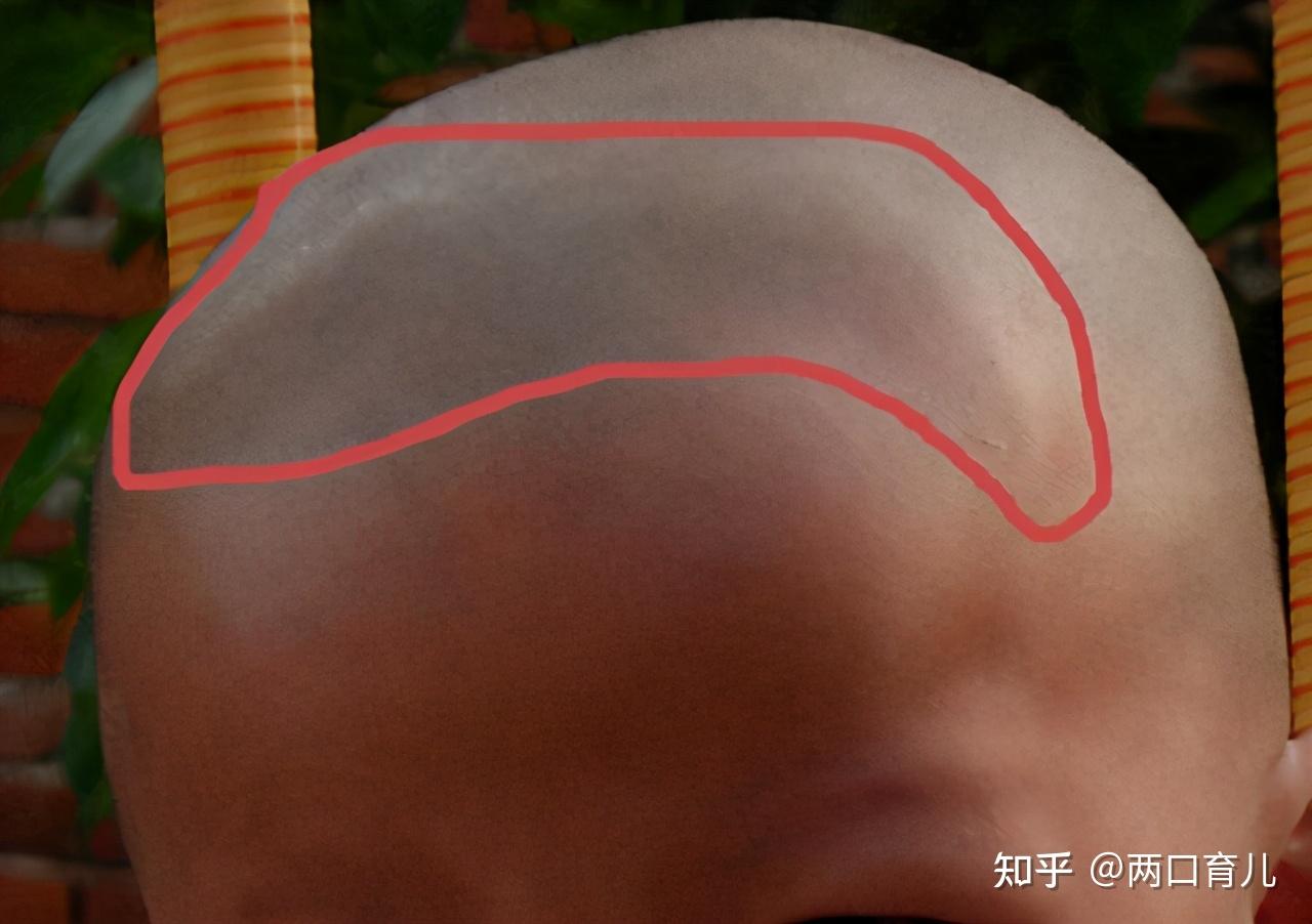 宝宝卤门护理有多重要如果出现这些情况要尽快带娃去医院