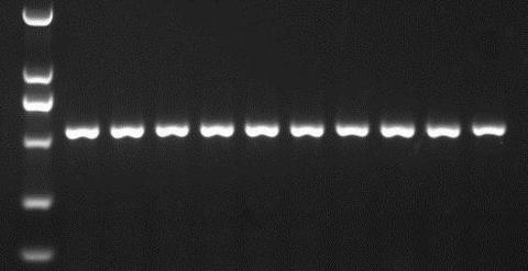 dna的琼脂糖凝胶电泳是生物学实验室中应用最为广泛的分子生物学实验