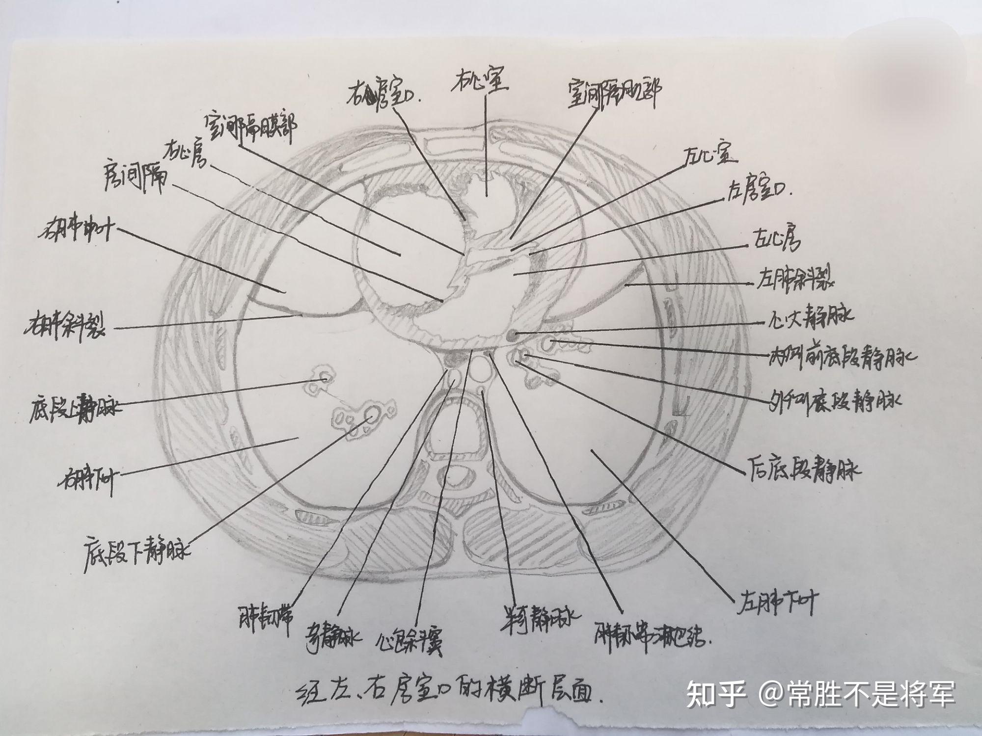 横断面图怎么画手绘图片