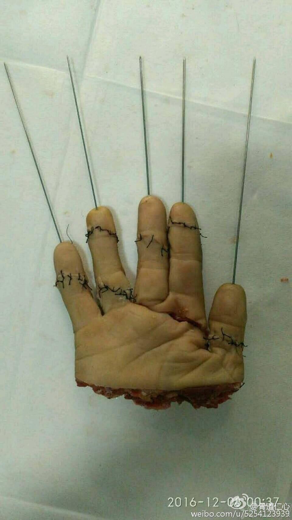 中国的临床医疗技术和美国差距有多大?