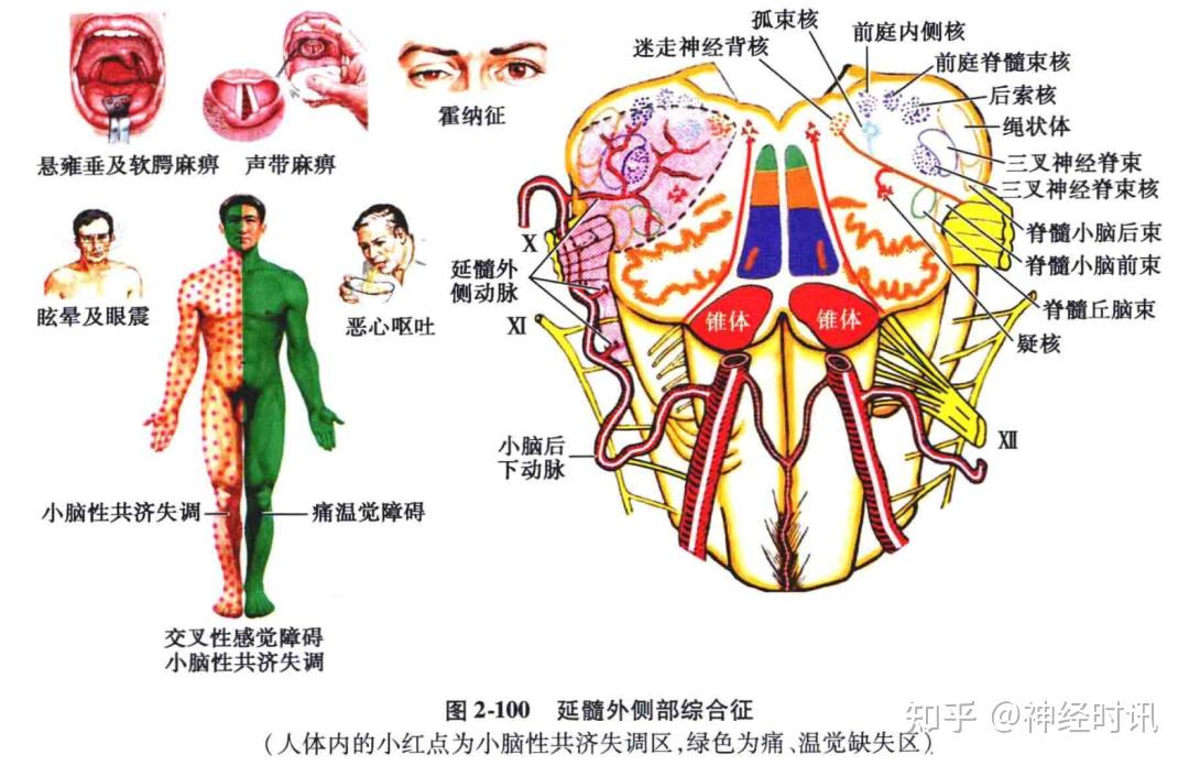 丘腦束相鄰很近,前者在內側,後者在外側,都位於脊髓小腦前束的內側,如