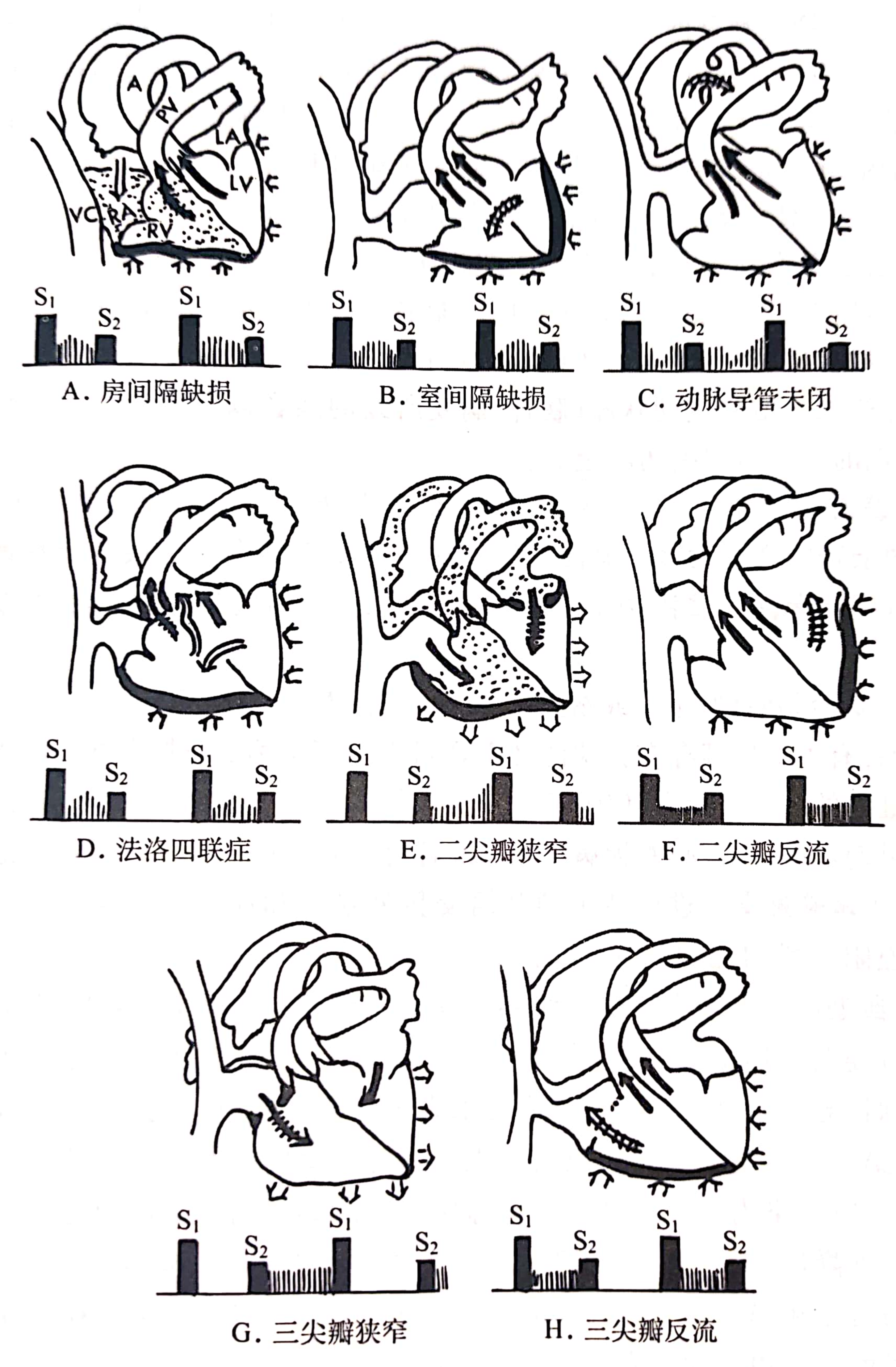 执业医师考试:心脏听诊简论 - 知乎