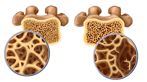 v2-2dc58046193a29897acec5134d8000d1_1440w.jpg?source=172ae18b