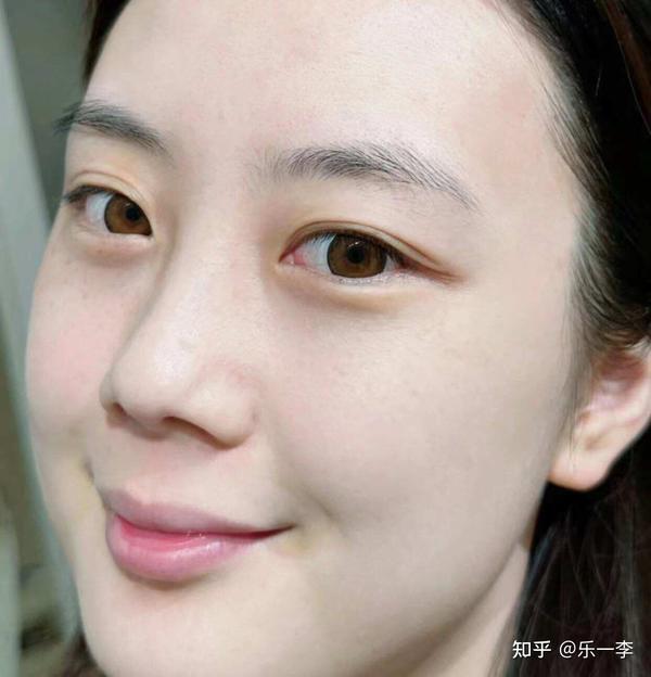 整整白了几个度,斑斑点点都隐形了~现在人送外号"雪白娃娃",整个