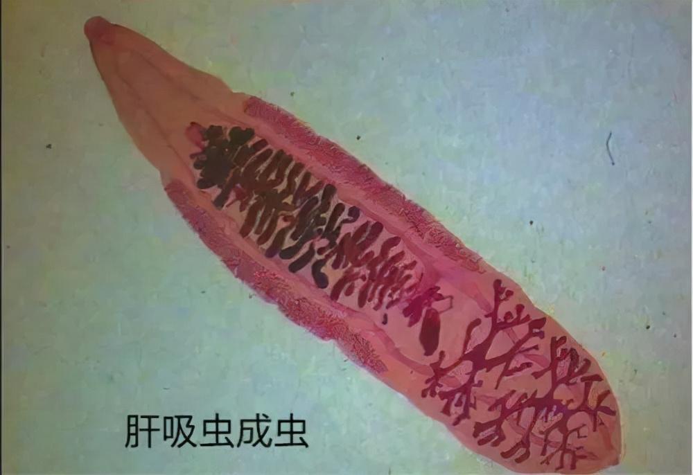 什么是肝吸虫病这种病真的是吃出来的