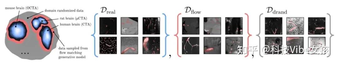 性能远超SAM系模型,苏黎世大学等开发通用3D血管分割基础模型 - 知乎