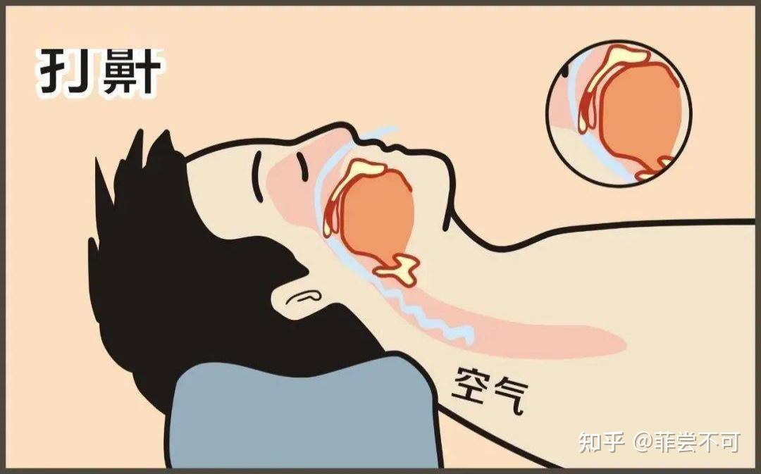 nitetronic添眠智能止鼾枕使用分享室友打鼾是一种什么体验室友每晚