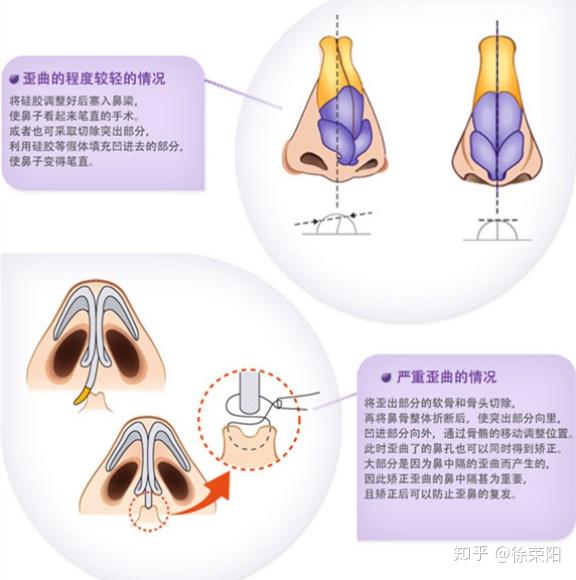 导购家电智慧生活频道_天极网