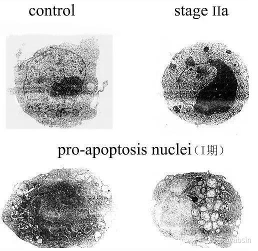 常用细胞凋亡检测方法 - 知乎